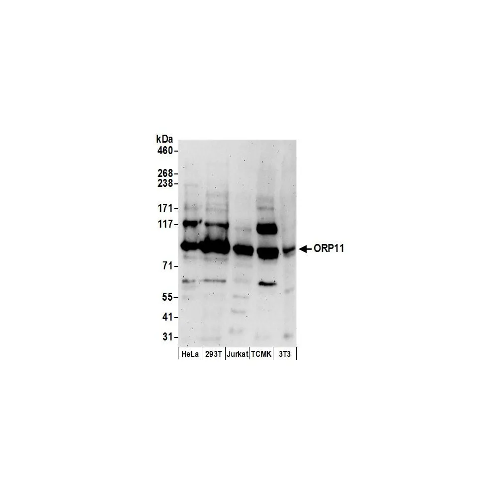 Rabbit anti-ORP11 Antibody, Affinity Purified