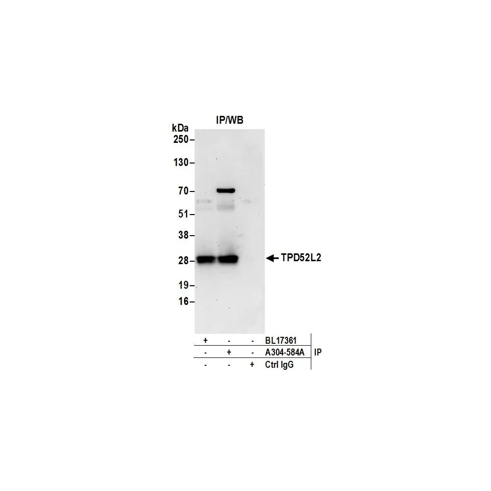 Rabbit anti-TPD52L2 Antibody, Affinity Purified