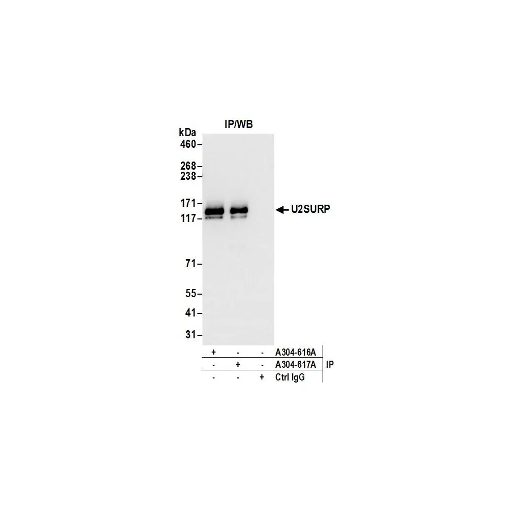Rabbit anti-U2SURP Antibody, Affinity Purified