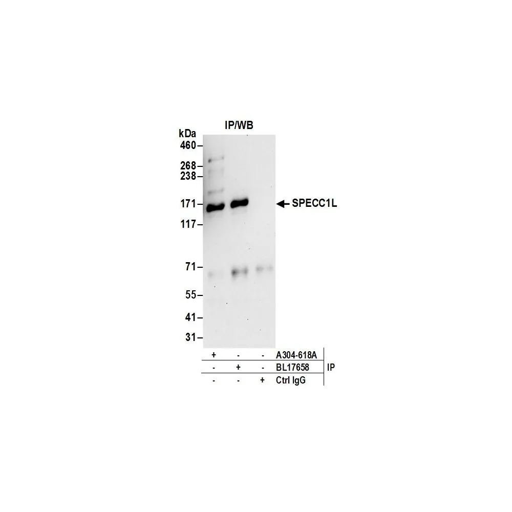 Rabbit anti-SPECC1L Antibody, Affinity Purified