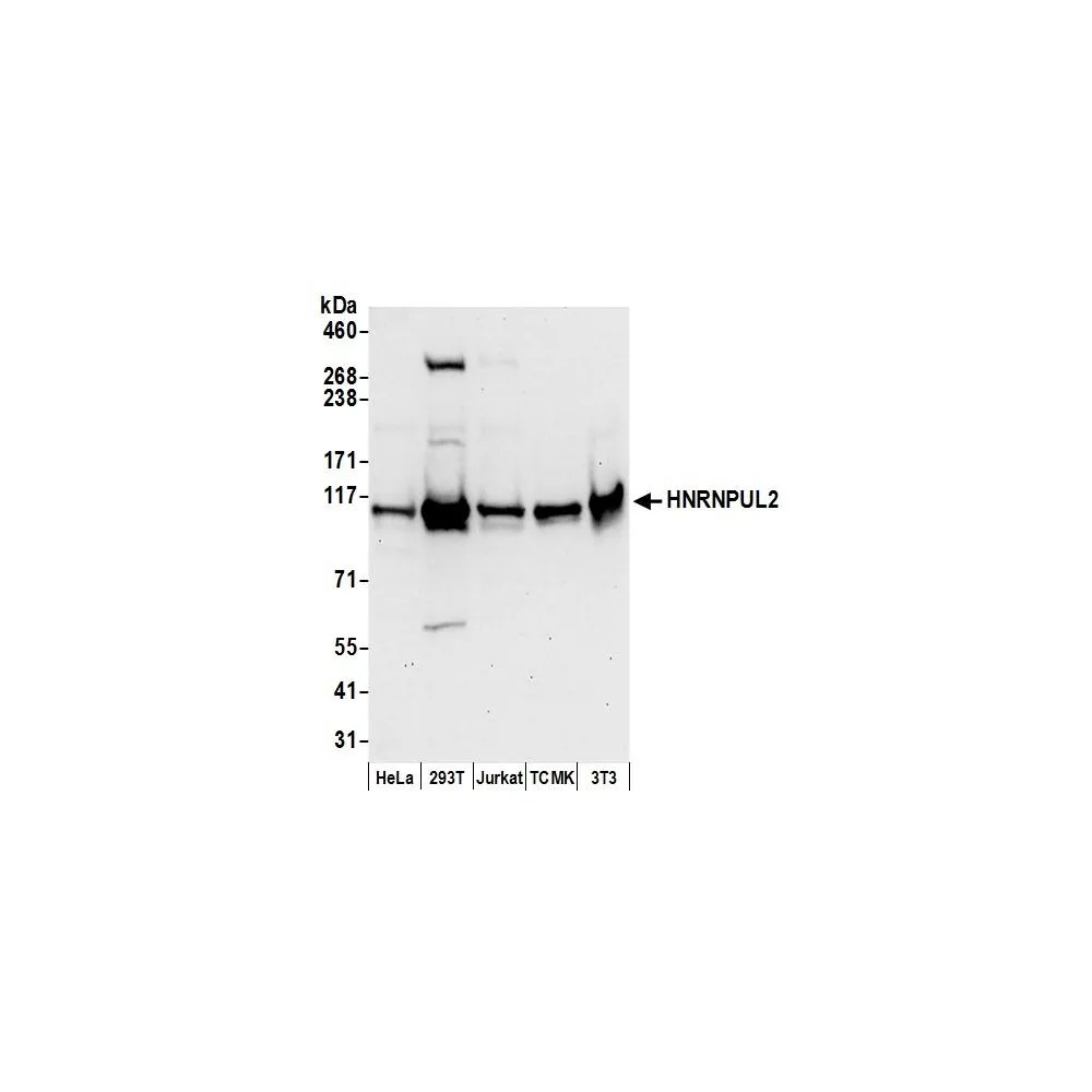 Rabbit anti-HNRNPUL2 Antibody, Affinity Purified