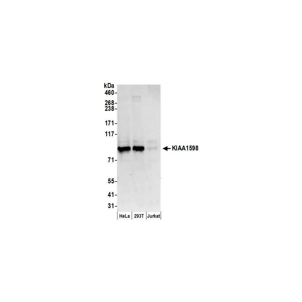Rabbit anti-KIAA1598 Antibody, Affinity Purified