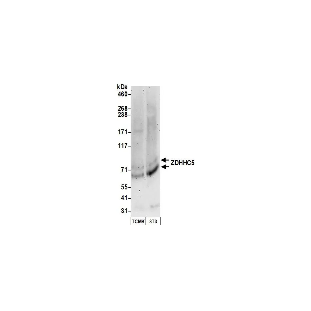 Rabbit anti-ZDHHC5 Antibody, Affinity Purified