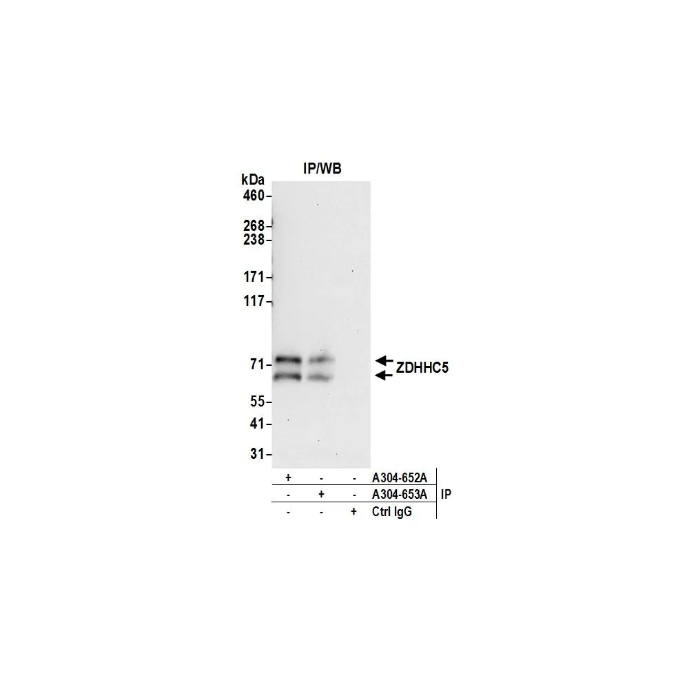 Rabbit anti-ZDHHC5 Antibody, Affinity Purified