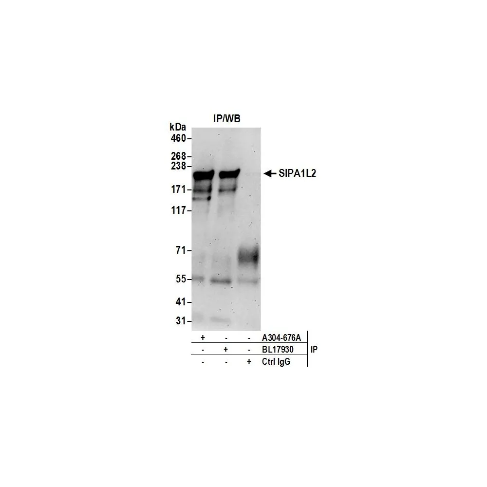 Rabbit anti-SIPA1L2 Antibody, Affinity Purified