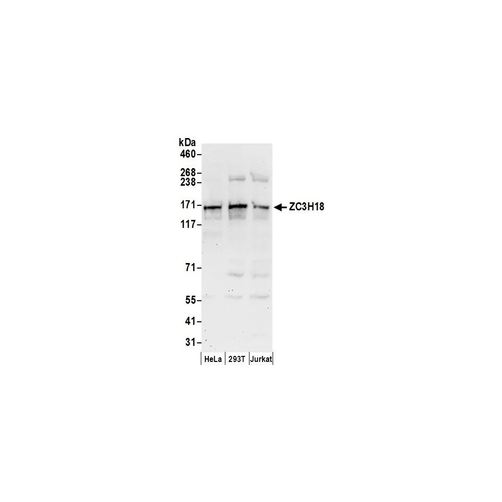 Rabbit anti-ZC3H18 Antibody, Affinity Purified