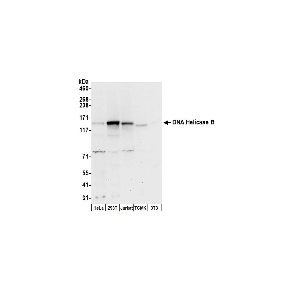 Rabbit anti-DNA Helicase B Antibody, Affinity Purified
