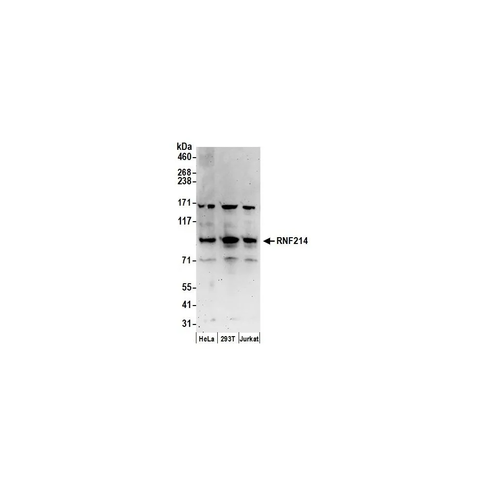 Rabbit anti-RNF214 Antibody, Affinity Purified