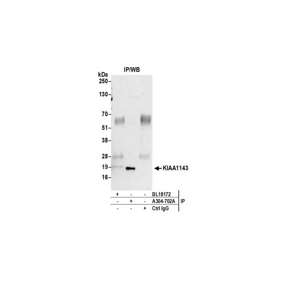 Rabbit anti-KIAA1143 Antibody, Affinity Purified