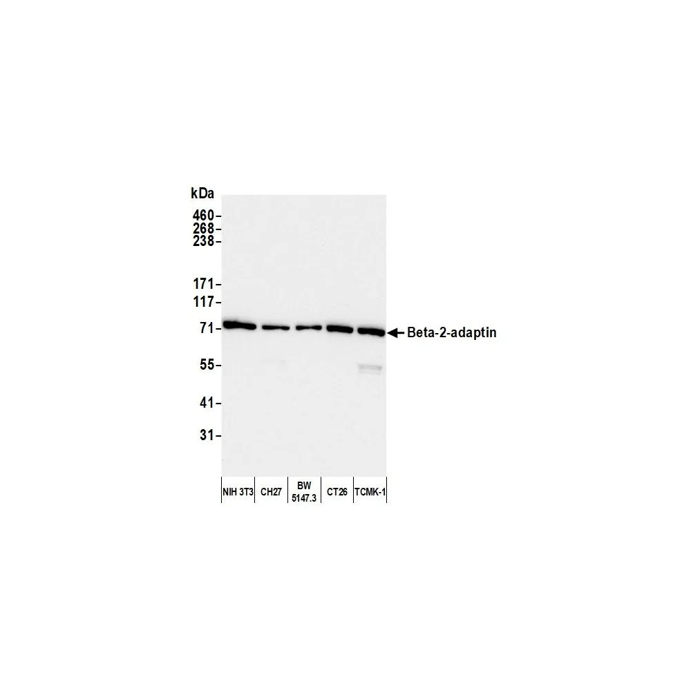Rabbit anti-Beta-2-adaptin Antibody, Affinity Purified