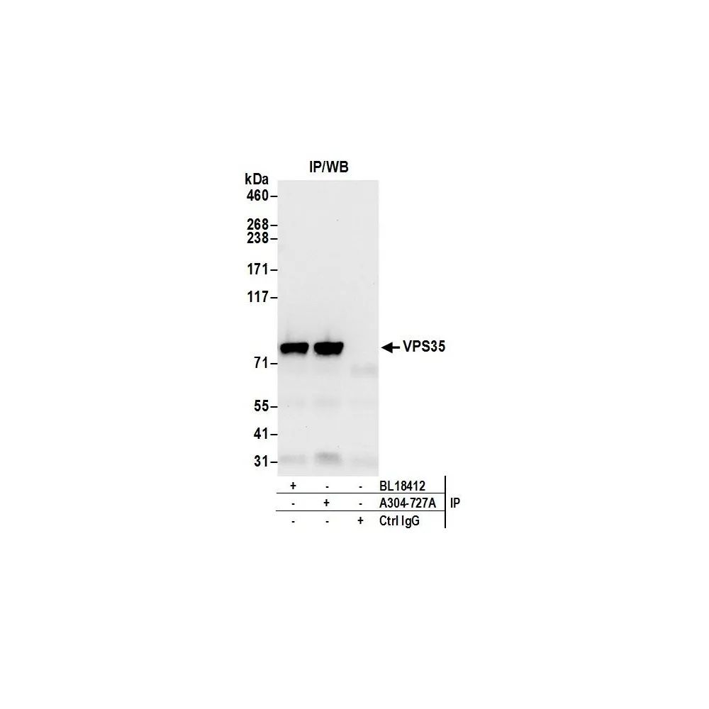 Rabbit anti-VPS35 Antibody, Affinity Purified