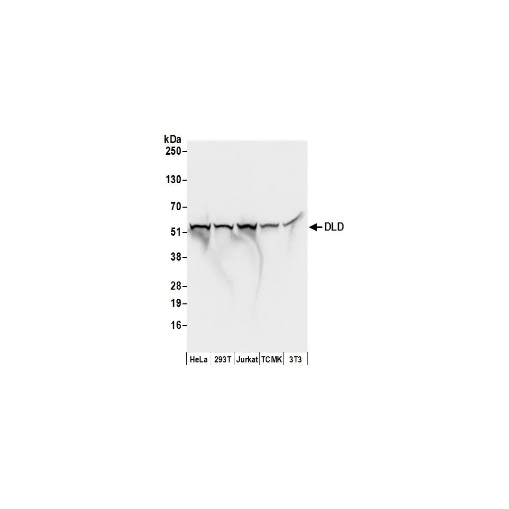 Rabbit anti-DLD Antibody, Affinity Purified