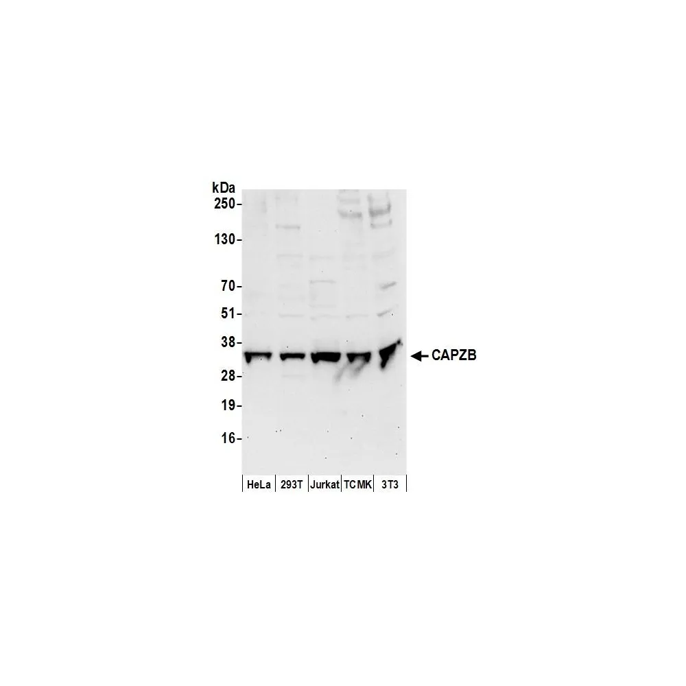 Rabbit anti-CAPZB Antibody, Affinity Purified