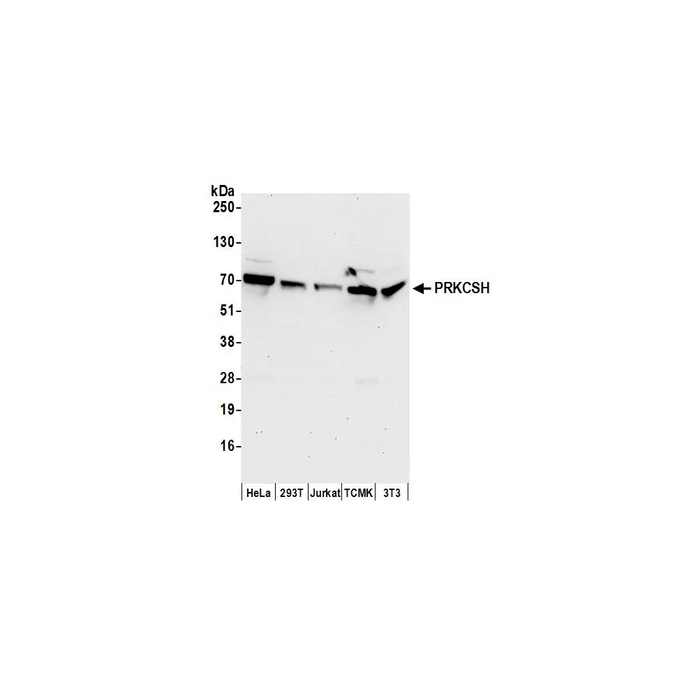 Rabbit anti-PRKCSH Antibody, Affinity Purified