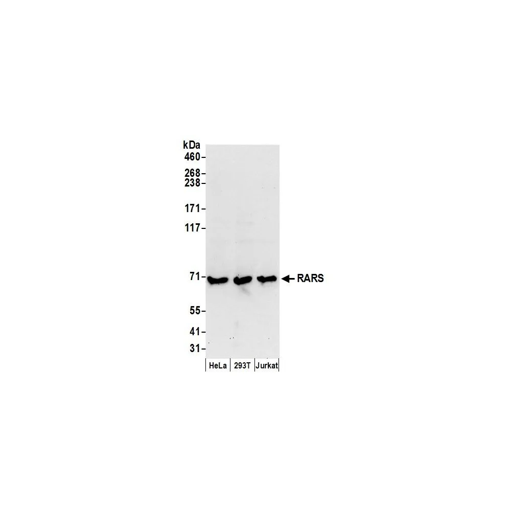 Rabbit anti-RARS Antibody, Affinity Purified