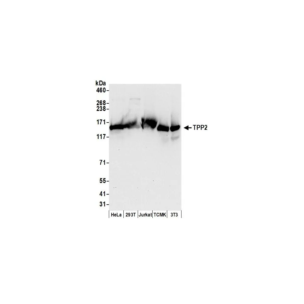 Rabbit anti-TPP2 Antibody, Affinity Purified