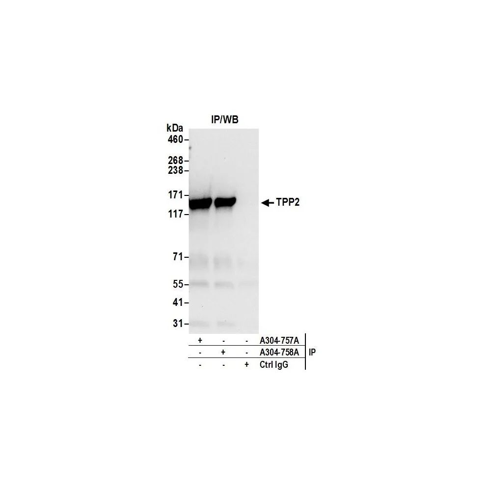 Rabbit anti-TPP2 Antibody, Affinity Purified
