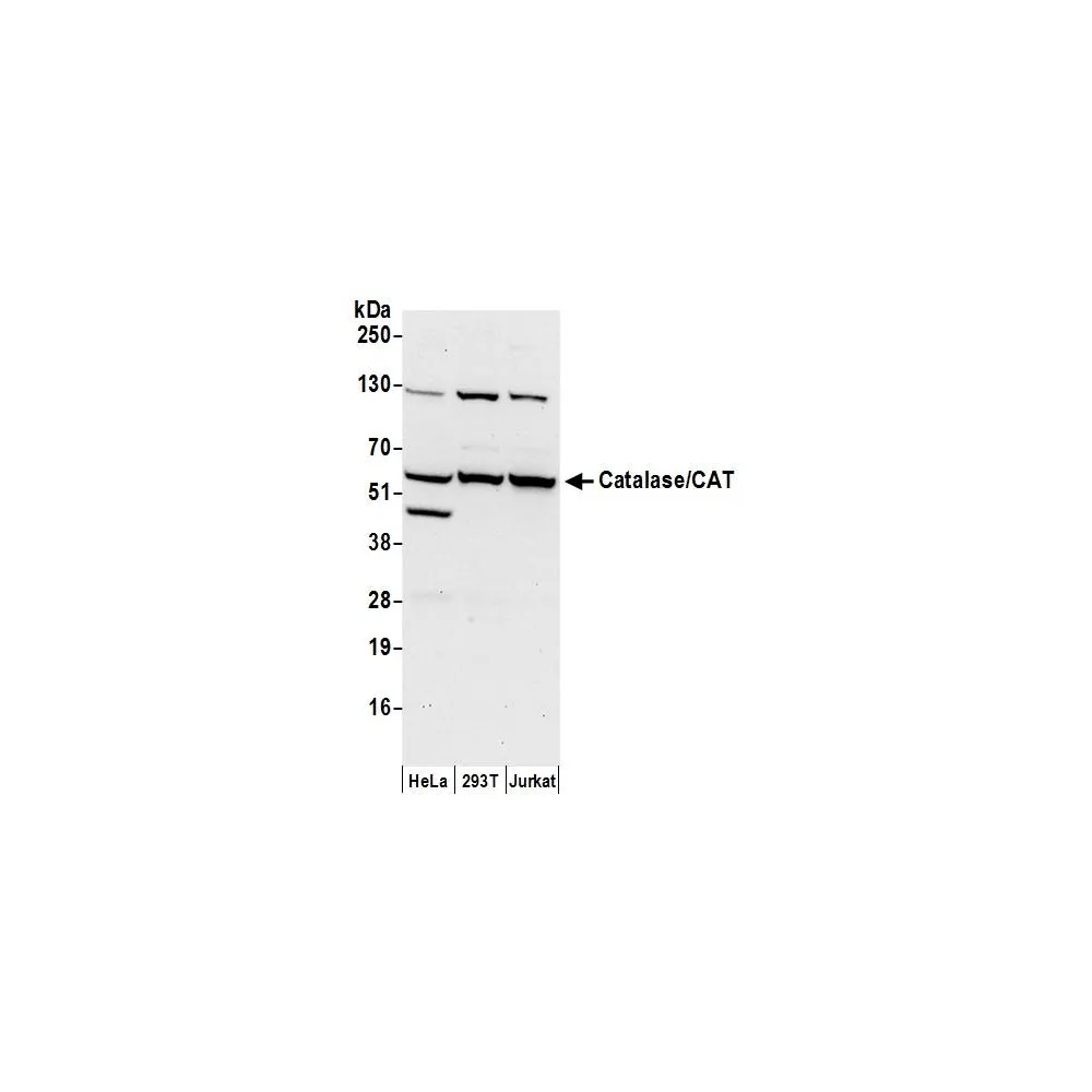 Rabbit anti-Catalase/CAT Antibody, Affinity Purified