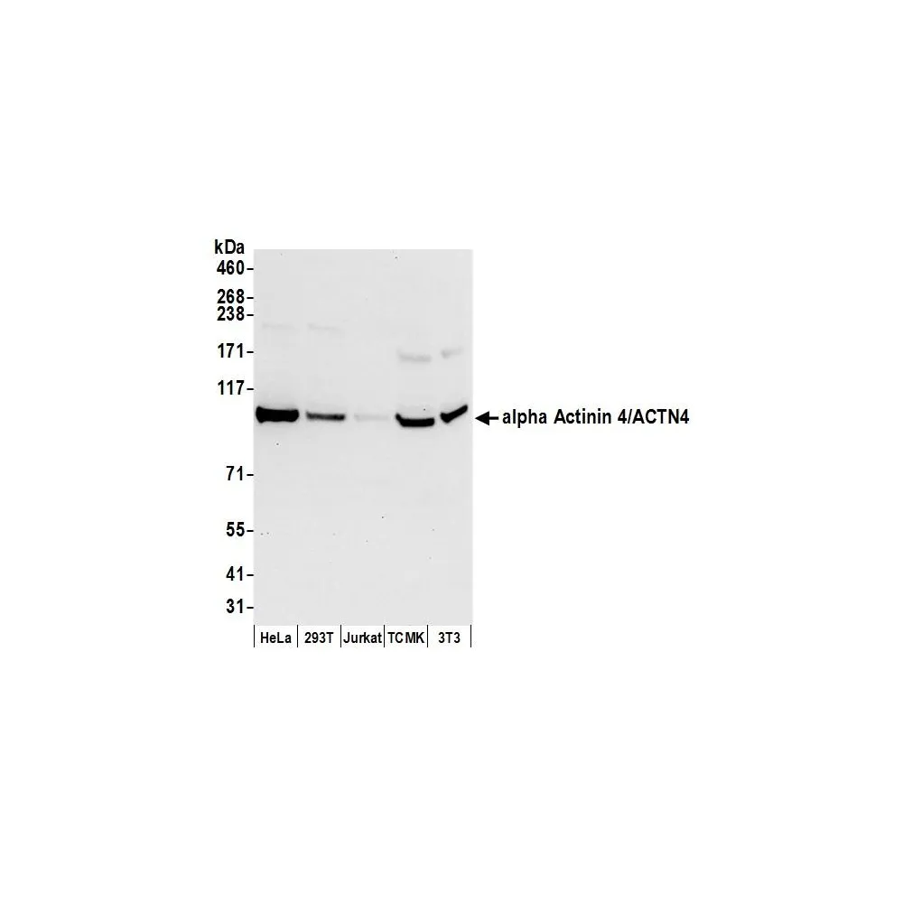 Rabbit anti-alpha Actinin 4/ACTN4 Antibody, Affinity Purified