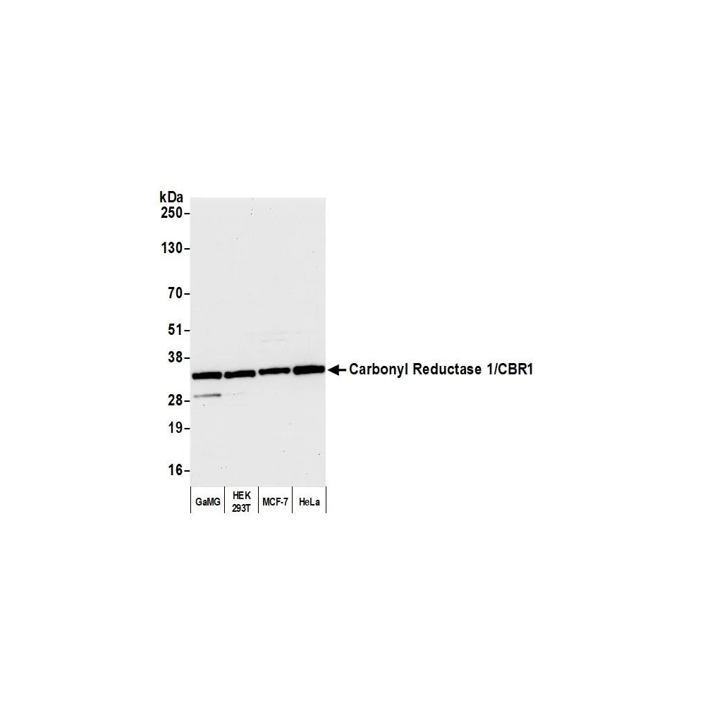Rabbit anti-Carbonyl Reductase 1/CBR1 Antibody, Affinity Purified