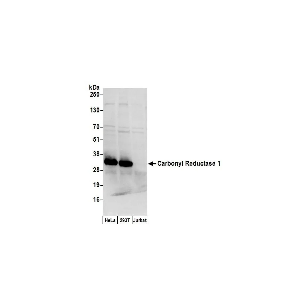 Rabbit anti-Carbonyl Reductase 1/CBR1 Antibody, Affinity Purified