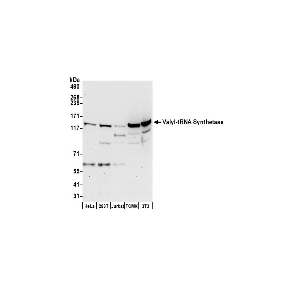 Rabbit anti-Valyl-tRNA Synthetase/VARS Antibody, Affinity Purified