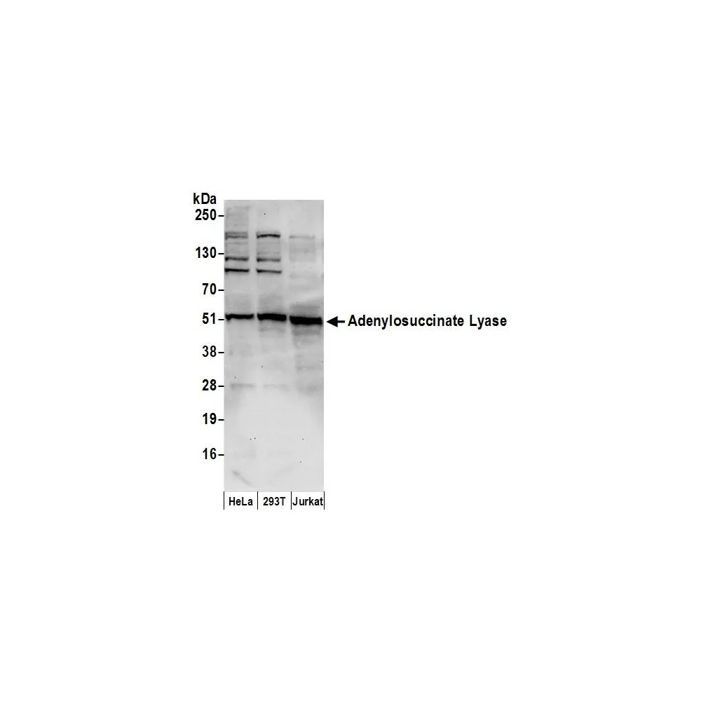 Rabbit anti-Adenylosuccinate Lyase/ADSL Antibody, Affinity Purified