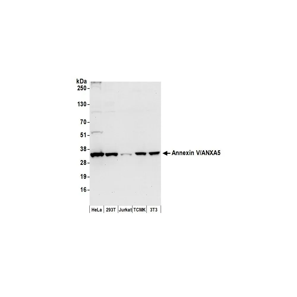 Rabbit anti-Annexin V/ANXA5 Antibody, Affinity Purified