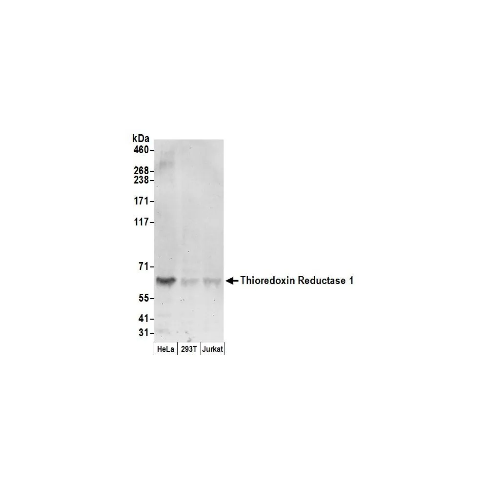 Rabbit anti-Thioredoxin Reductase 1/TXNRD1/TRXR1 Antibody, Affinity Purified