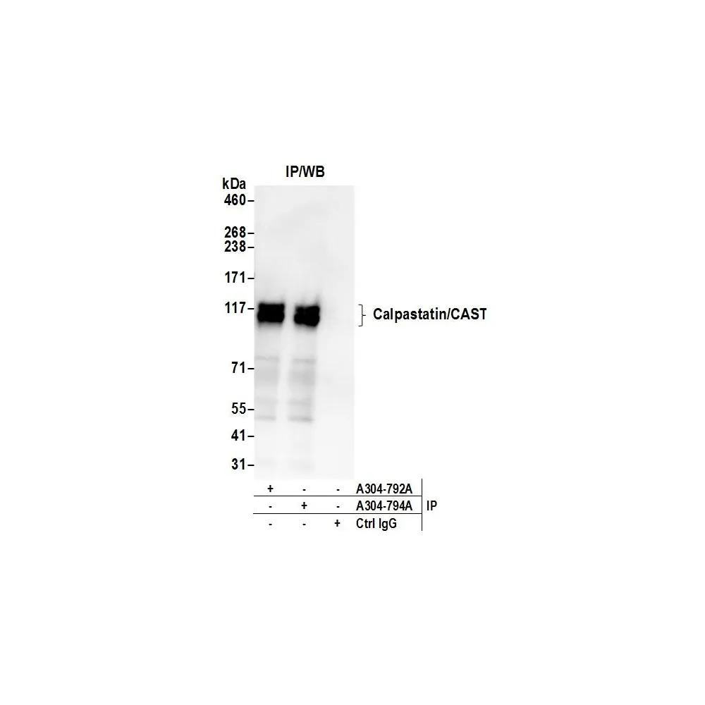 Rabbit anti-Calpastatin/CAST Antibody, Affinity Purified