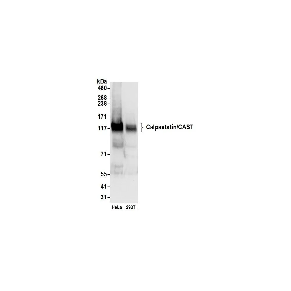 Rabbit anti-Calpastatin/CAST Antibody, Affinity Purified