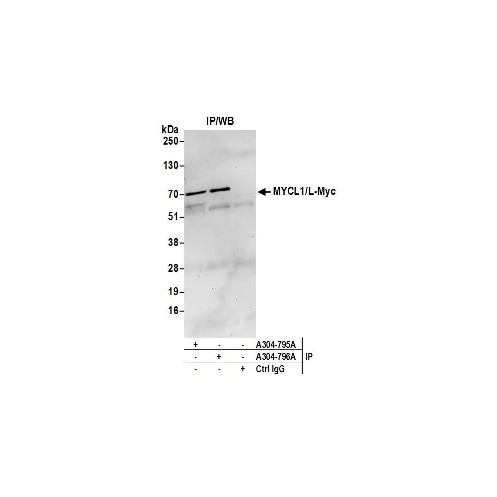 Rabbit anti-MYCL1/L-Myc Antibody, Affinity Purified