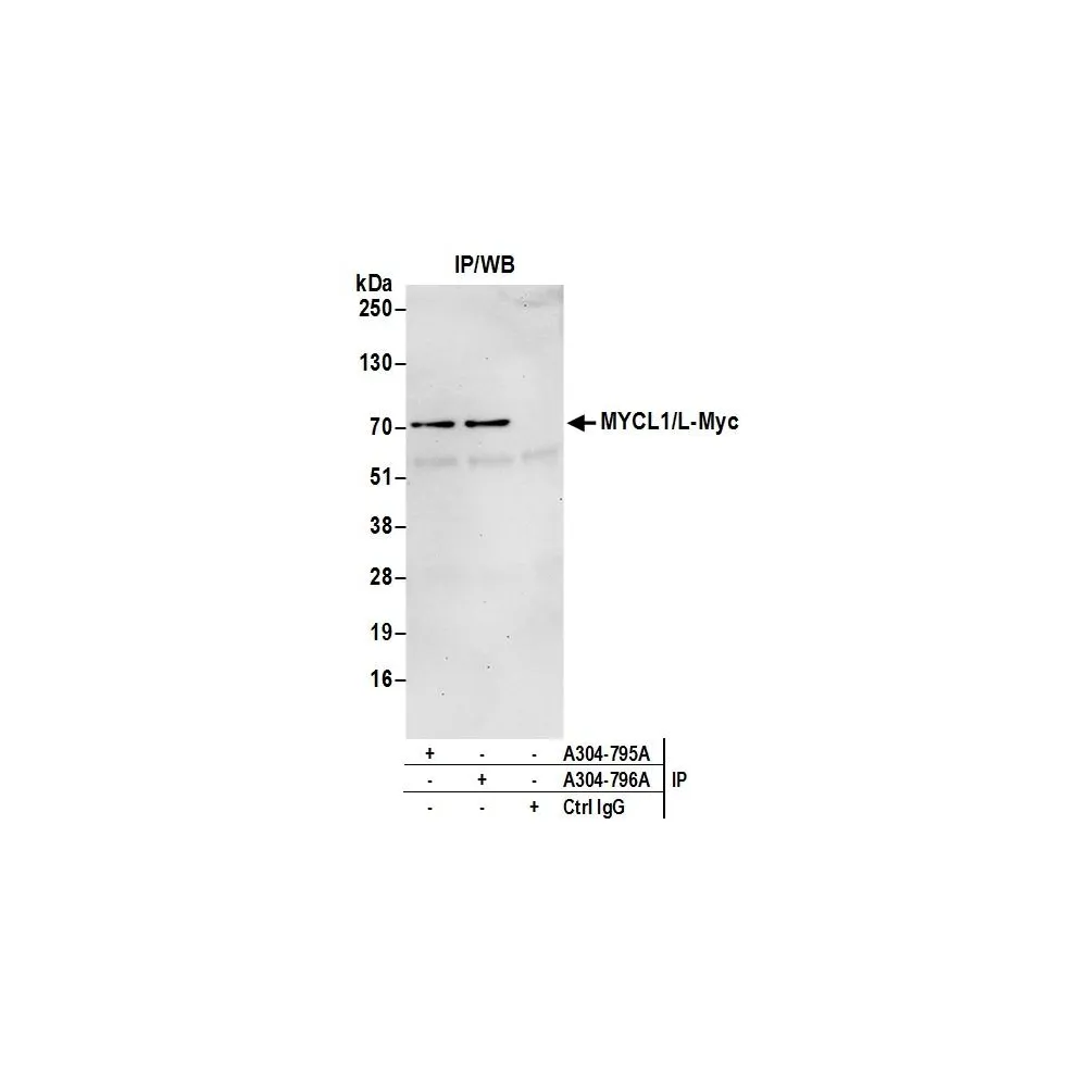 Rabbit anti-MYCL1/L-Myc Antibody, Affinity Purified