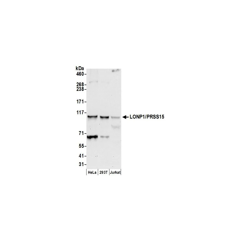 Rabbit anti-LONP1/PRSS15 Antibody, Affinity Purified