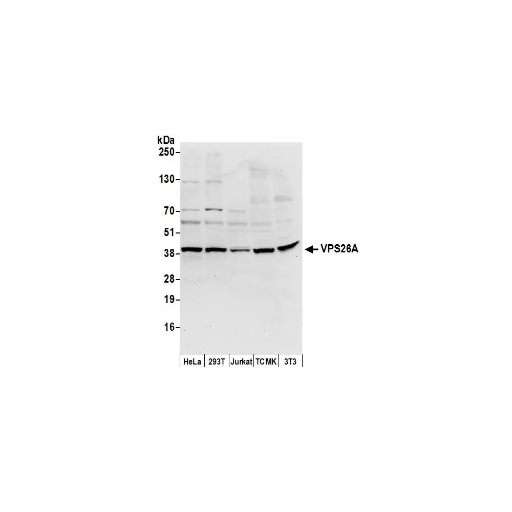 Rabbit anti-VPS26A Antibody, Affinity Purified