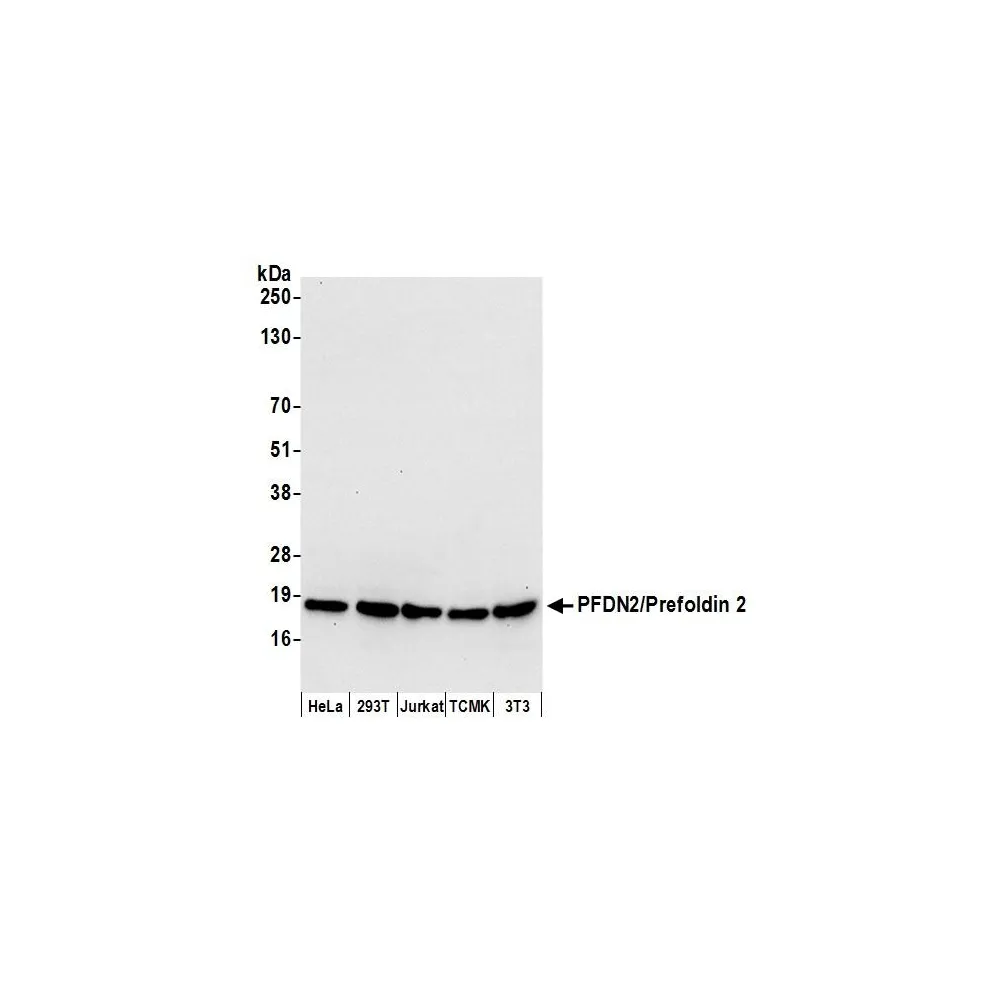 Rabbit anti-PFDN2/Prefoldin 2 Antibody, Affinity Purified