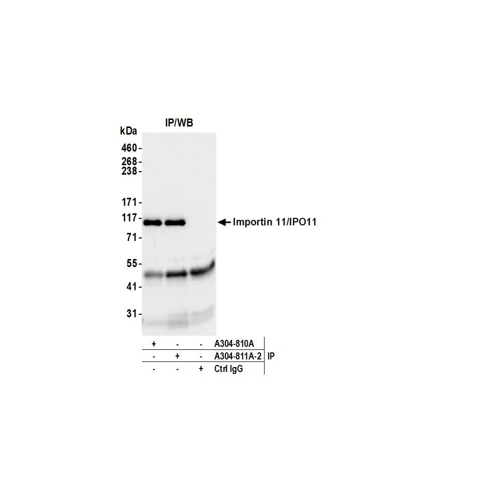 Rabbit anti-Importin 11/IPO11 Antibody, Affinity Purified