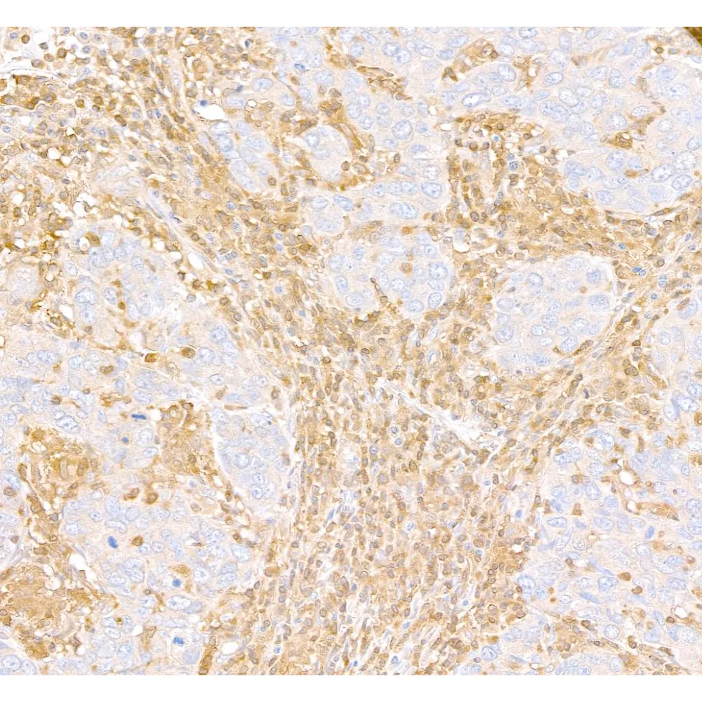 Rabbit anti-ARHGDIB/D4-GDI/RhoGDI2 Antibody, Affinity Purified
