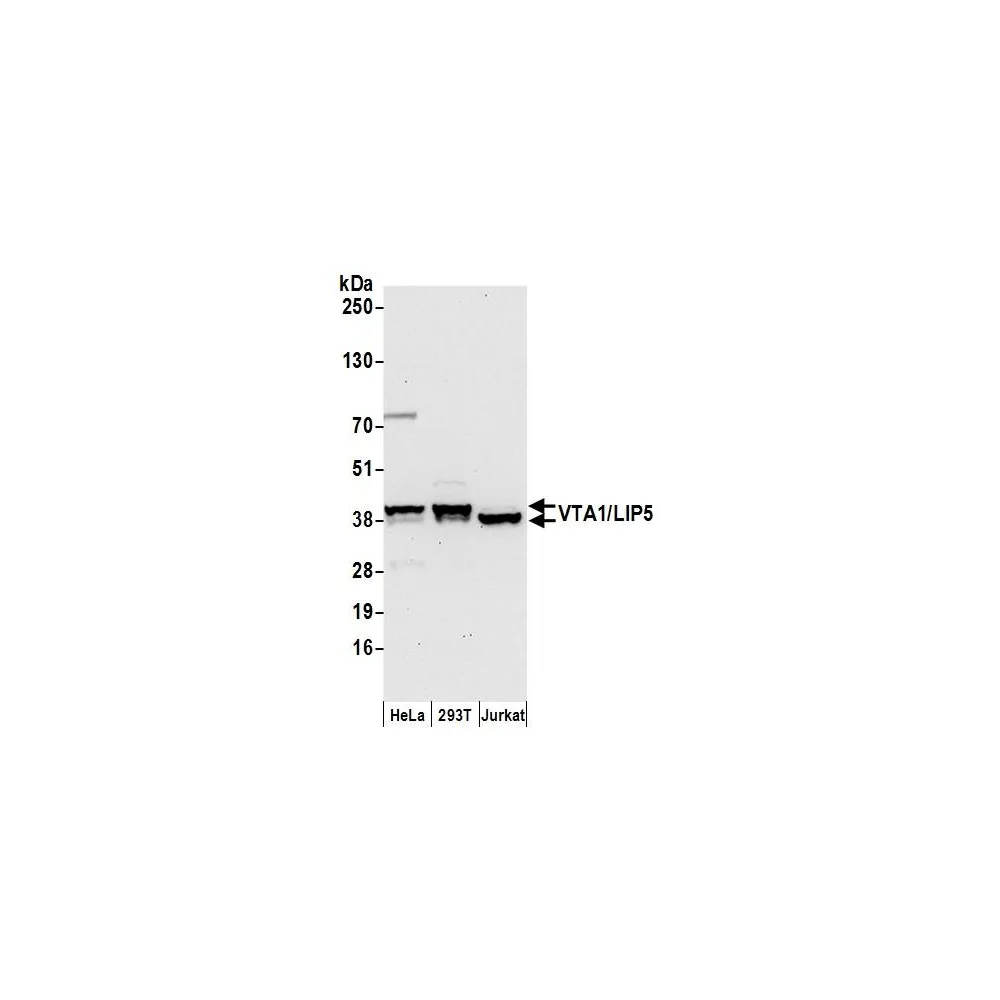 Rabbit anti-VTA1/LIP5 Antibody, Affinity Purified