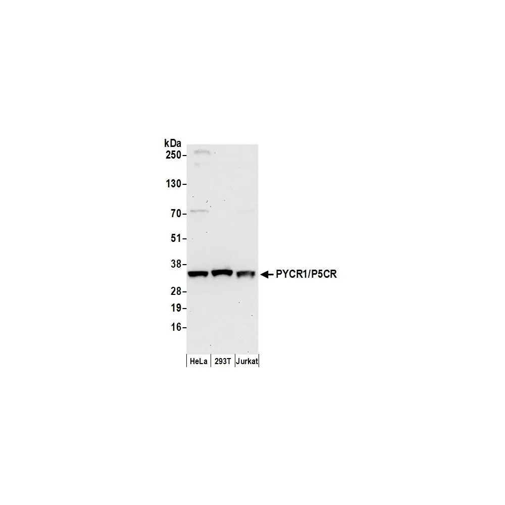 Rabbit anti-PYCR1/P5CR Antibody, Affinity Purified