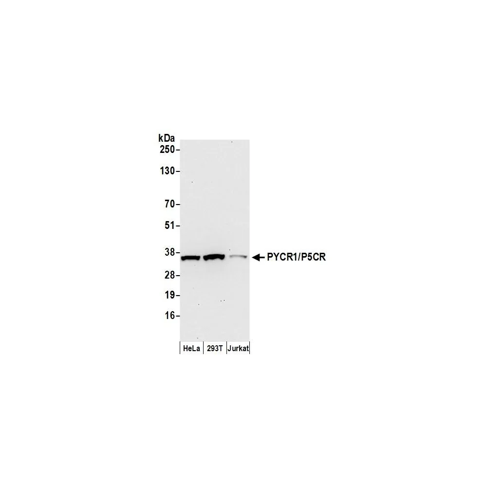 Rabbit anti-PYCR1/P5CR Antibody, Affinity Purified