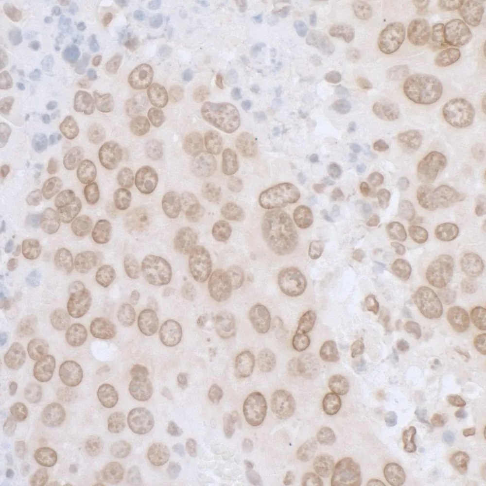 Rabbit anti-LAP2 alpha beta gamma/TMPO Antibody, Affinity Purified