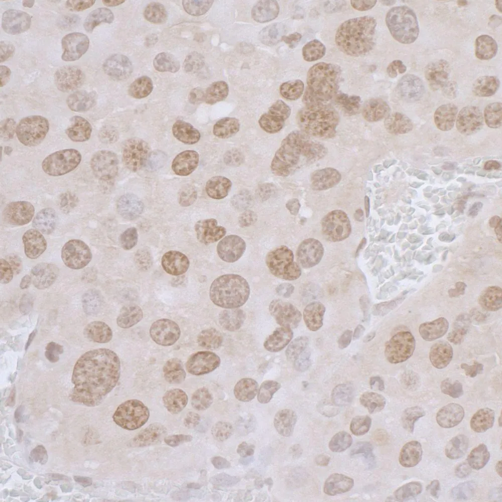 Rabbit anti-LAP2 alpha/TMPO Antibody, Affinity Purified