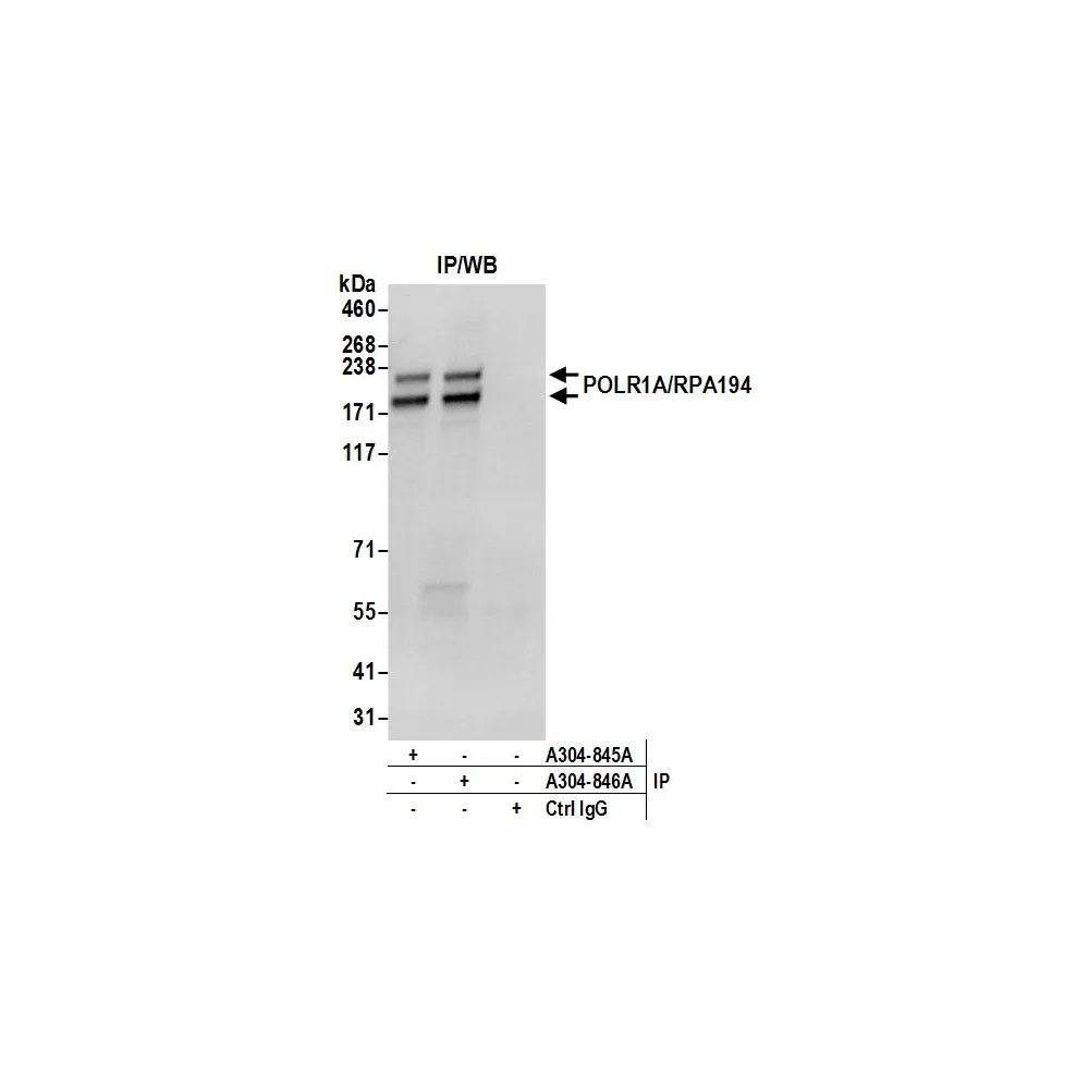 Rabbit anti-POLR1A/RPA194 Antibody, Affinity Purified