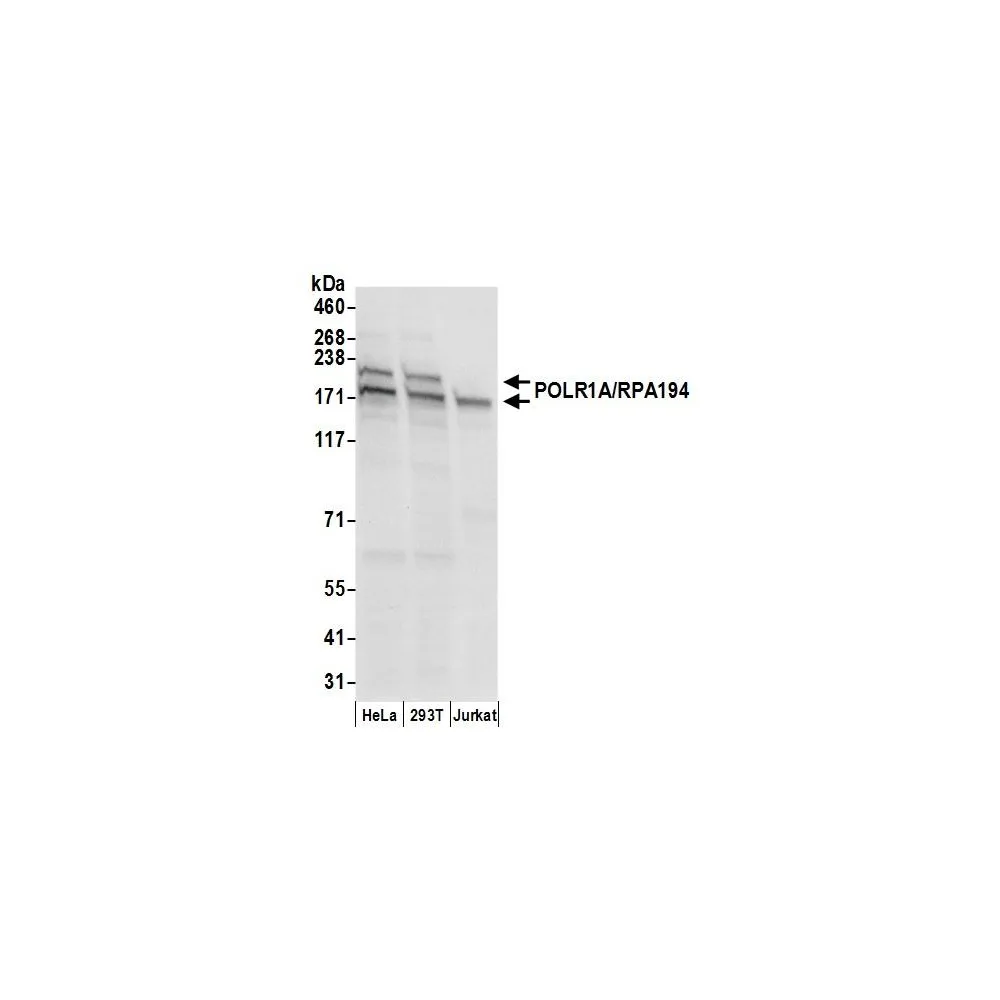 Rabbit anti-POLR1A/RPA194 Antibody, Affinity Purified