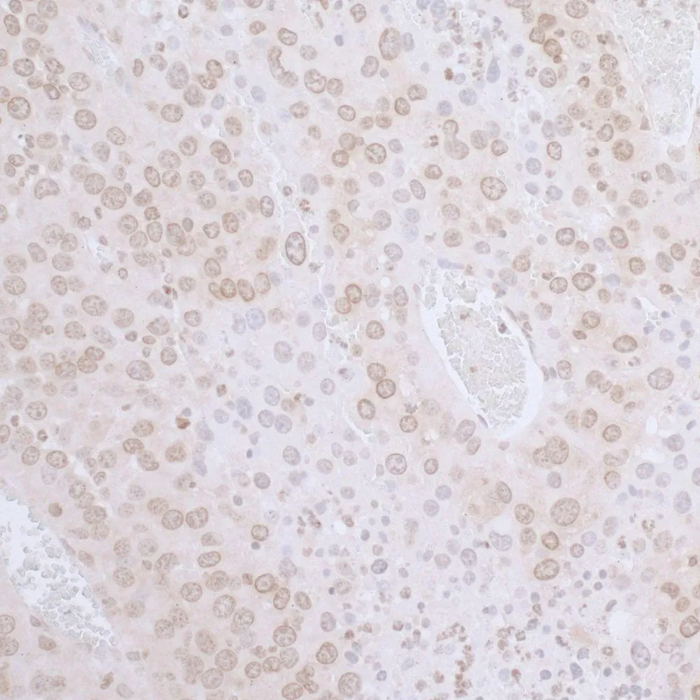 Rabbit anti-LAP2 beta gamma/TMPO Antibody, Affinity Purified
