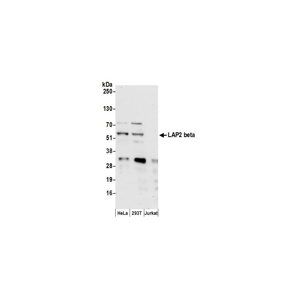 Rabbit anti-LAP2 beta gamma/TMPO Antibody, Affinity Purified
