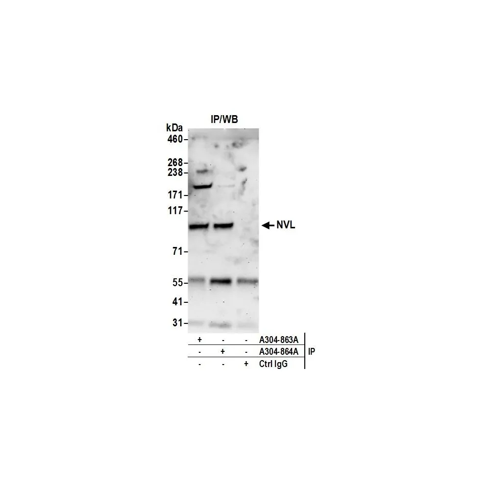 Rabbit anti-NVL Antibody, Affinity Purified