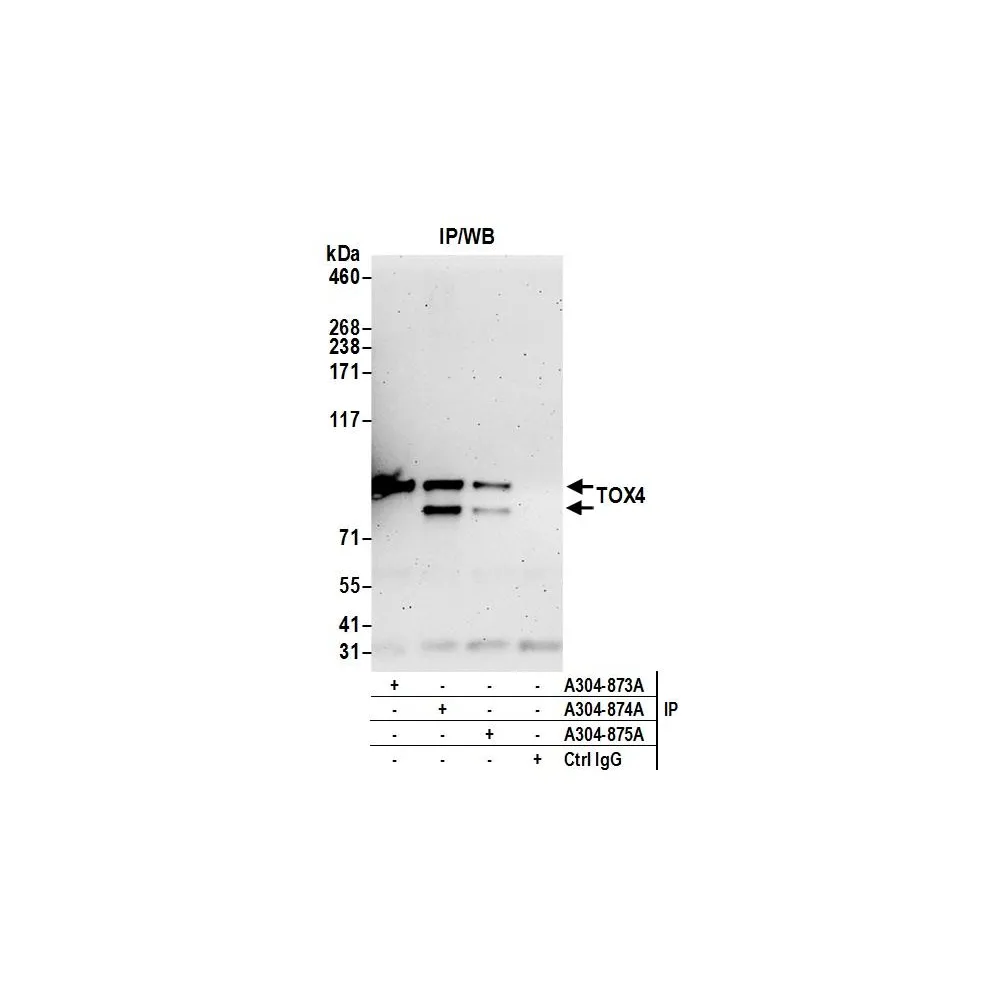 Rabbit anti-TOX4 Antibody, Affinity Purified