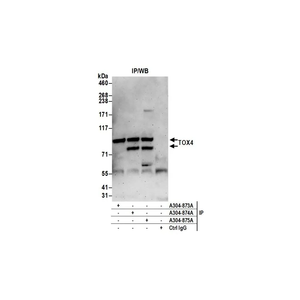 Rabbit anti-TOX4 Antibody, Affinity Purified